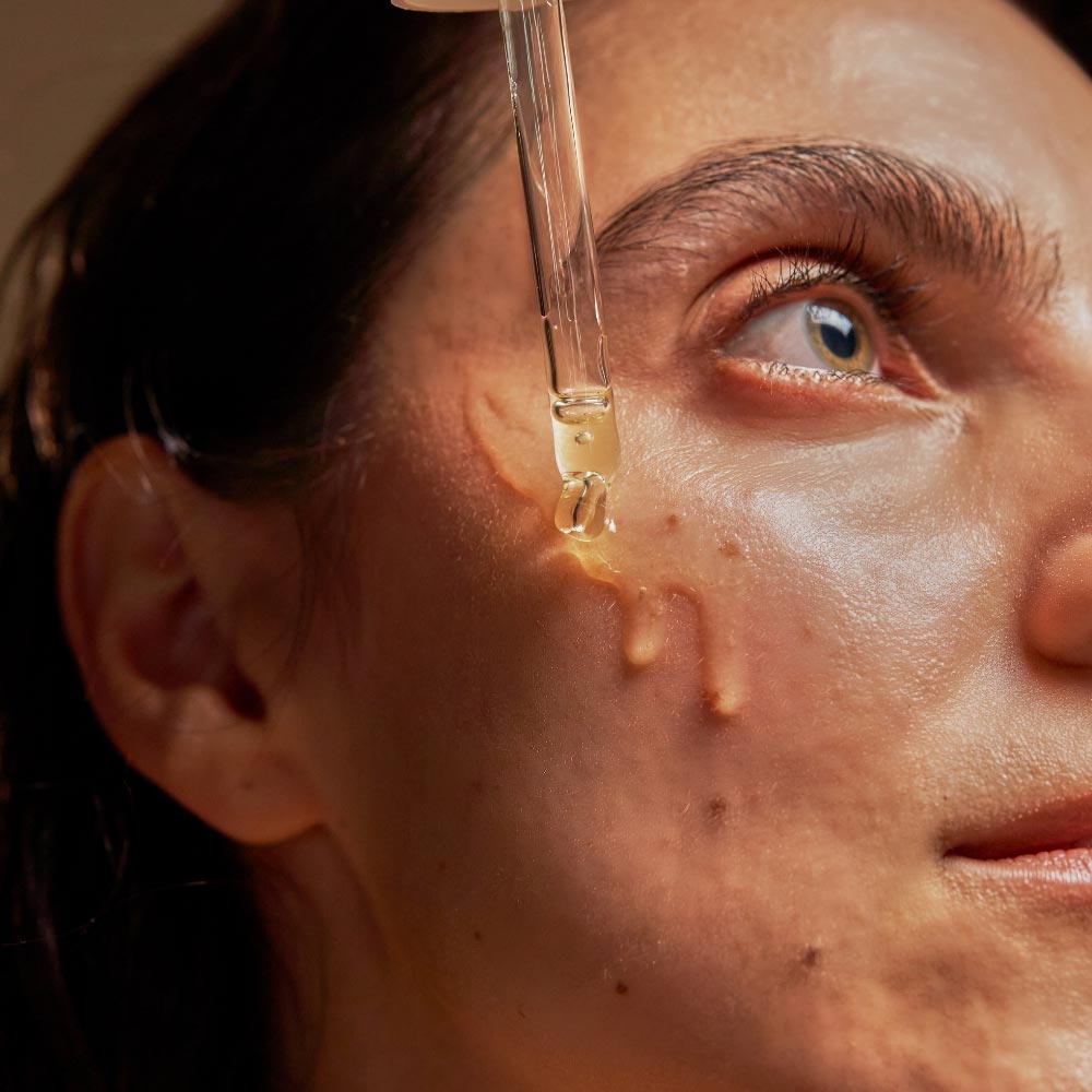 Unreinheiten & vergrößerte Poren