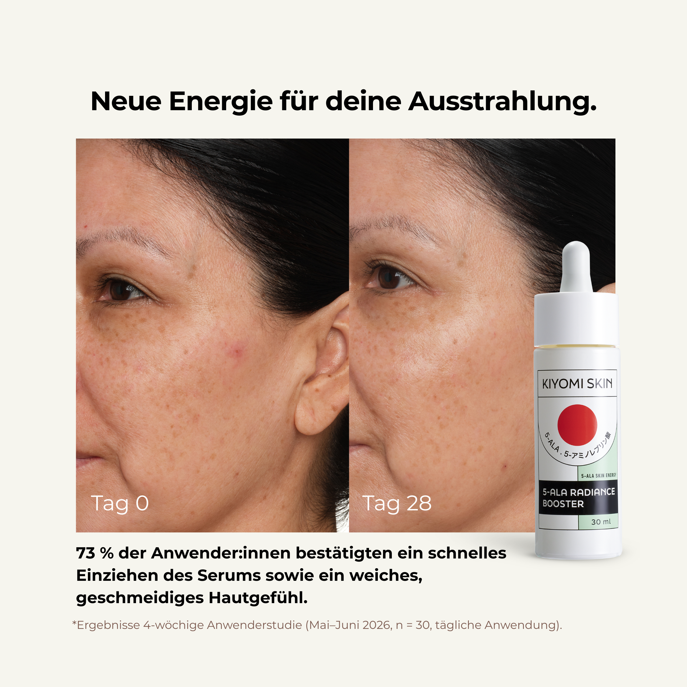 Before and after using 5-ALA Radiance Booster over 28 days, a woman's face shows a more even, radiant complexion. Image features serum bottle and German text noting fast absorption and smooth skin feel.