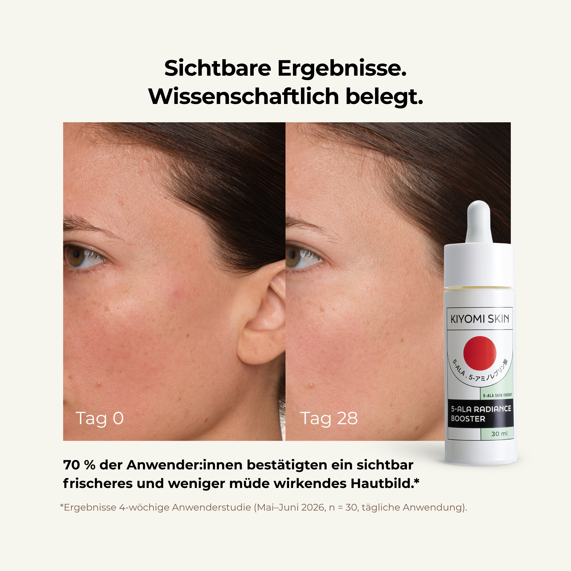 Close-up of a woman's cheek, before and after using 5-ALA Radiance Booster Serum, showing improved skin radiance and visible results on day 28.