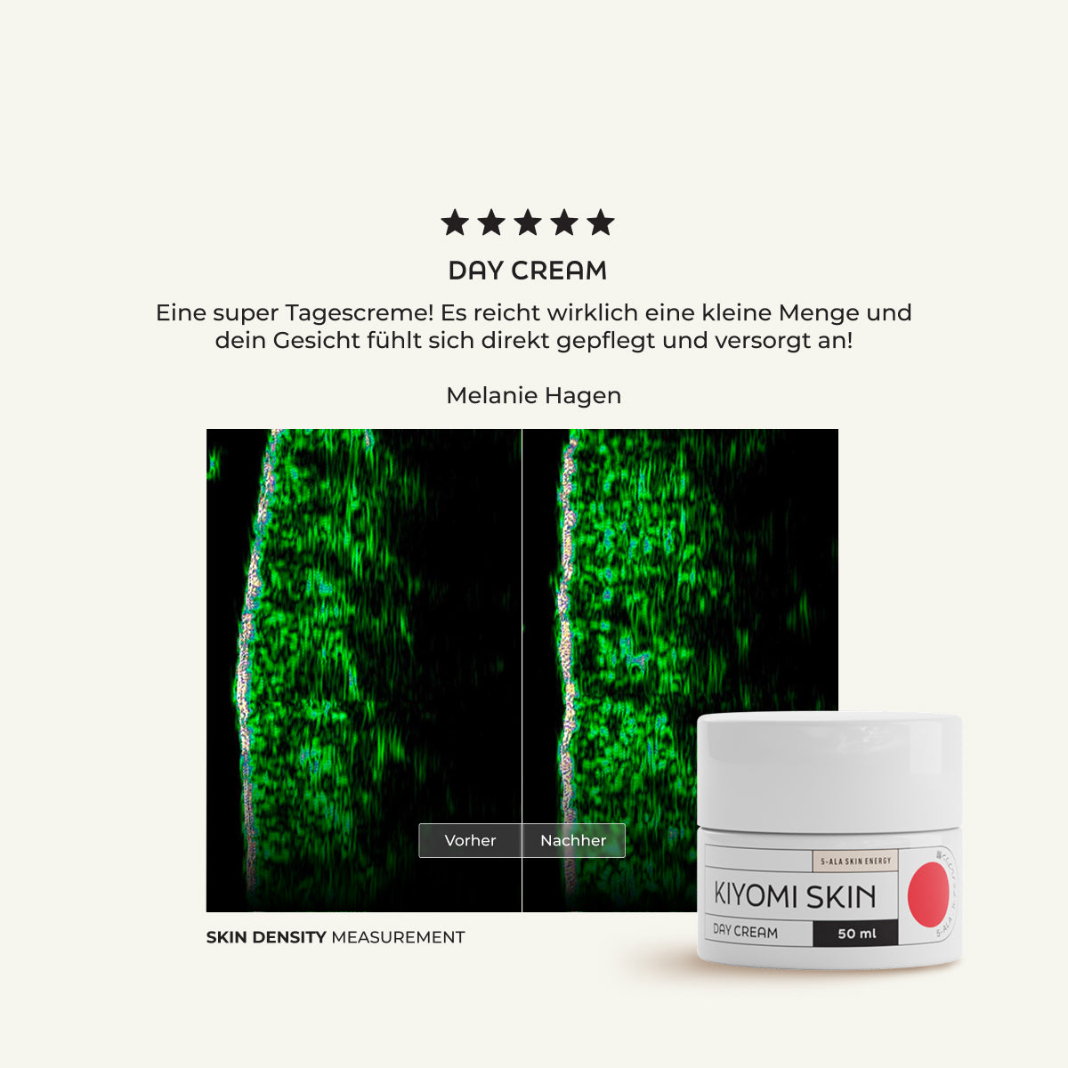Two skin density scans labeled Vorher and Nachher, with an Easy Glow Duo jar shown below, highlighting the visibly improved complexion and natürlicher Glow achieved through regular use of the Easy Glow Duo.