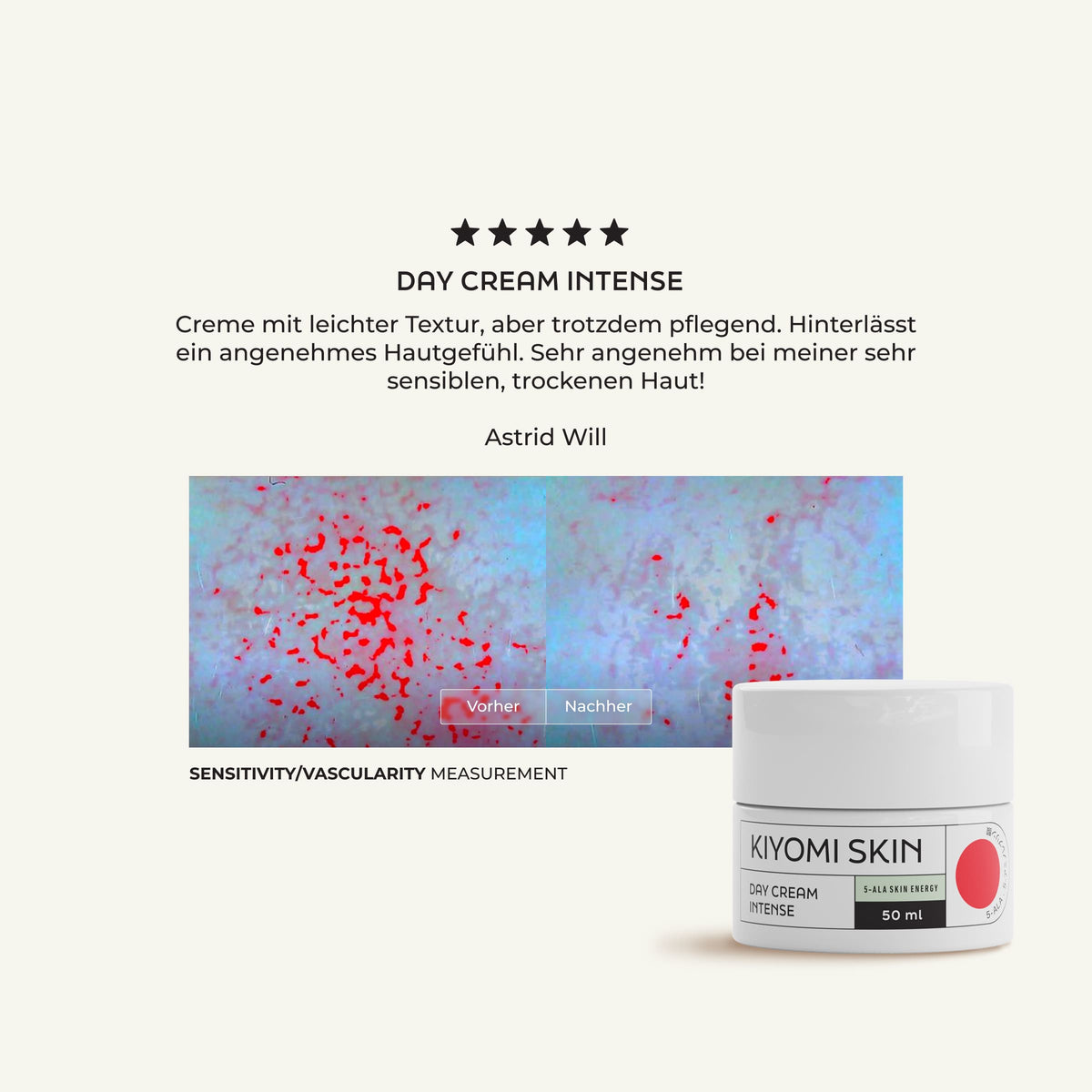 Testbericht zur „Day Cream Intense“ von SBI ALApromo mit rot markierten Bildern aus dem Empfindlichkeitstest, auf denen der Cremetiegel und ein deutsches Kundenfeedback zu sehen sind. Diese 5-ALA-Creme wurde für die intensive Gesichtspflege entwickelt und eignet sich daher ideal für empfindliche Haut.